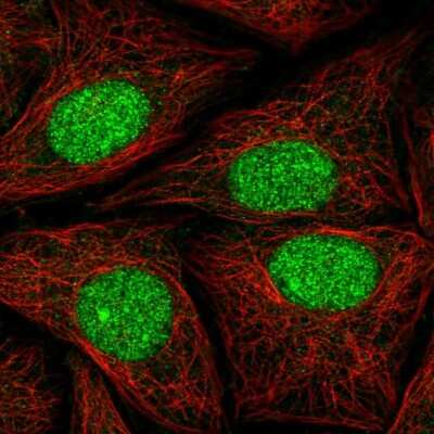 Immunocytochemistry/ Immunofluorescence: ATXN1L Antibody [NBP2-57478]