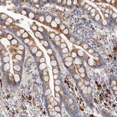 Immunohistochemistry: ATXN3L Antibody [NBP1-93456]