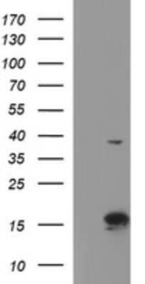 Western Blot: ATXN7L1 Antibody (OTI4F6) [NBP2-46558]