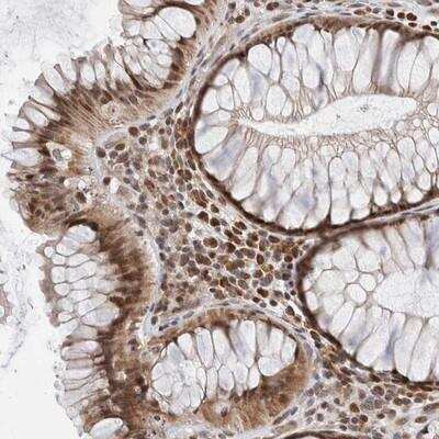 Immunohistochemistry-Paraffin: ATXN7L1 Antibody [NBP1-88914]