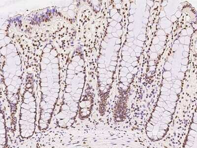 Immunohistochemistry-Paraffin: ATXN7L1 Antibody [NBP2-97598]