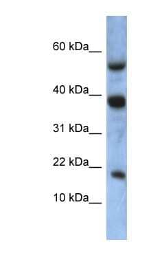 Western Blot: ATXN7L1 Antibody [NBP1-56311]