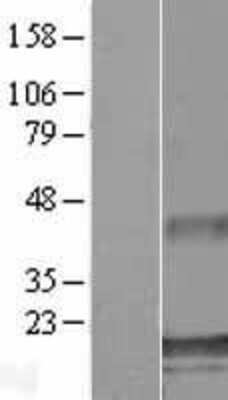 Western Blot: ATXN7L1 Overexpression Lysate [NBL1-07854]