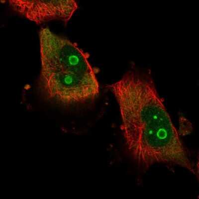 Immunocytochemistry/ Immunofluorescence: ATXN7L2 Antibody [NBP2-58692]