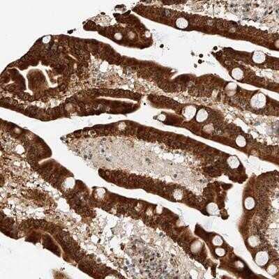 Immunohistochemistry-Paraffin: ATXN7L2 Antibody [NBP1-83876]