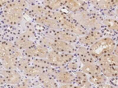 Immunohistochemistry-Paraffin: ATXN7L2 Antibody [NBP2-98179]