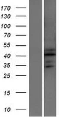 Western Blot: ATXN7L2 Overexpression Lysate [NBP2-05257]