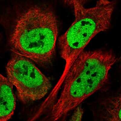 Immunocytochemistry/ Immunofluorescence: ATXN7L3B Antibody [NBP2-56815]