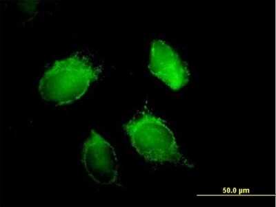Immunocytochemistry/ Immunofluorescence: AUF1 Antibody [H00003184-B01P]