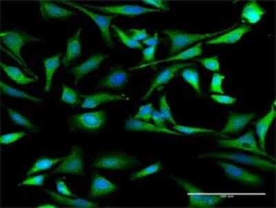 Immunocytochemistry/ Immunofluorescence: AUF1 Antibody [H00003184-D01P]