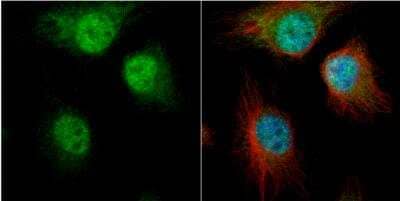 Immunocytochemistry/ Immunofluorescence: AUF1 Antibody [NBP2-15528]