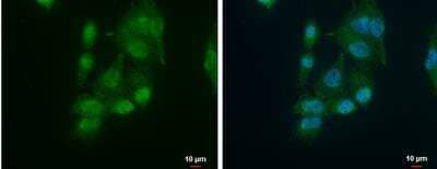 Immunocytochemistry/ Immunofluorescence: AUF1 Antibody [NBP2-15528]