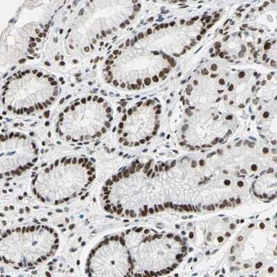 Immunohistochemistry-Paraffin: AUF1 Antibody [NBP1-88915]