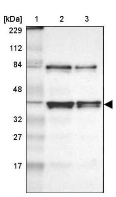 Western Blot: AUF1 Antibody [NBP1-88915]