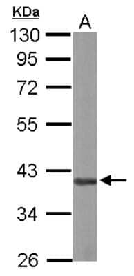 Western Blot: AUF1 Antibody [NBP2-15527]