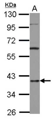 Western Blot: AUF1 Antibody [NBP2-15528]