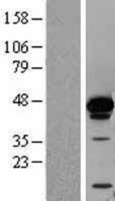 Western Blot: AUF1 Overexpression Lysate [NBL1-11641]