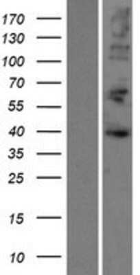 Western Blot: AUF1 Overexpression Lysate [NBP2-09923]