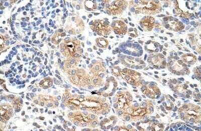 Immunohistochemistry-Paraffin: AUH Antibody [NBP1-57375]