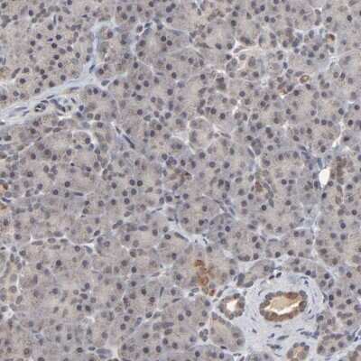 Immunohistochemistry-Paraffin: AUH Antibody [NBP1-86516]