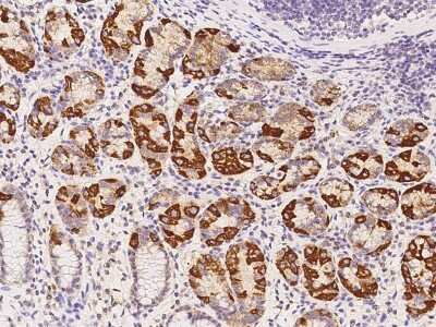 Immunohistochemistry-Paraffin: AUH Antibody [NBP2-97719]