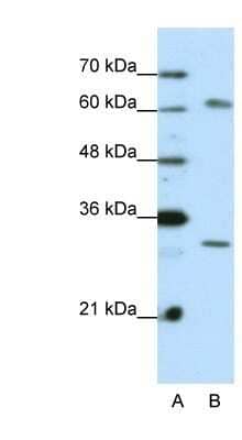 Western Blot: AUH Antibody [NBP1-57375]