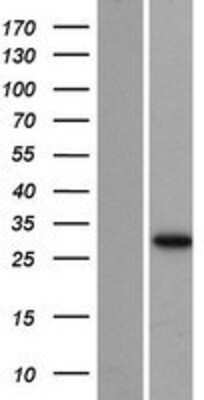 Western Blot: AUH Overexpression Lysate [NBP2-08182]