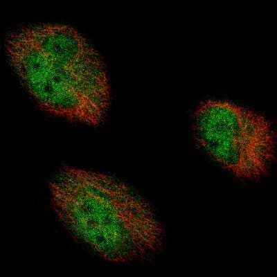 Immunocytochemistry/ Immunofluorescence: AUTS2 Antibody (CL7067) [NBP2-76529]