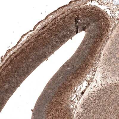 Immunohistochemistry-Paraffin: AUTS2 Antibody (CL7067) [NBP2-76529]