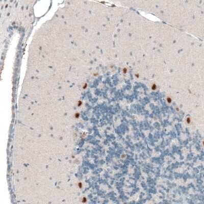 Immunohistochemistry-Paraffin: AUTS2 Antibody (CL7084) [NBP2-76530]