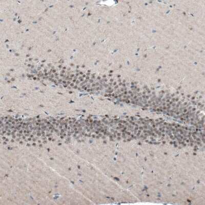 Immunohistochemistry-Paraffin: AUTS2 Antibody (CL7084) [NBP2-76530]