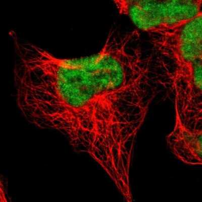 Immunocytochemistry/ Immunofluorescence: AUTS2 Antibody [NBP1-84717]