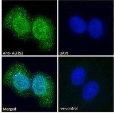 Immunocytochemistry/ Immunofluorescence: AUTS2 Antibody [NBP3-05291]