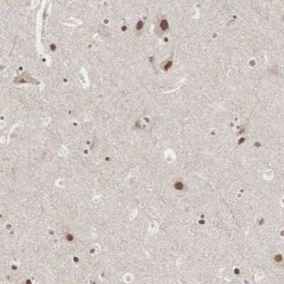 Immunohistochemistry-Paraffin: AUTS2 Antibody [NBP1-84717]
