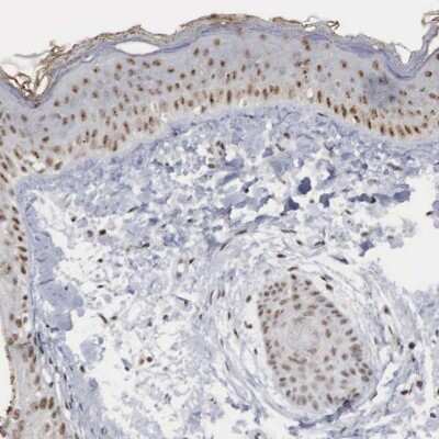 Immunohistochemistry-Paraffin: AUTS2 Antibody [NBP1-84717]