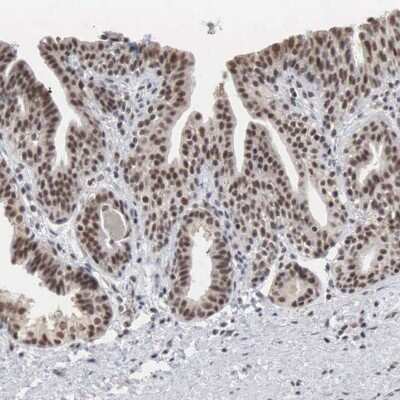 Immunohistochemistry-Paraffin: AUTS2 Antibody [NBP1-84717]