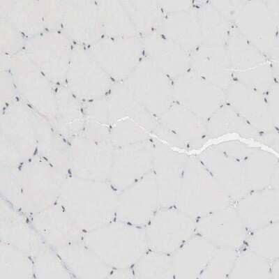 Immunohistochemistry-Paraffin: AUTS2 Antibody [NBP1-84717]
