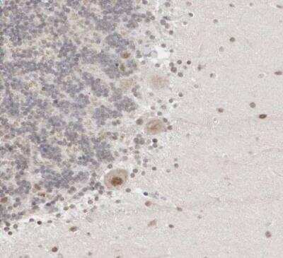 Immunohistochemistry-Paraffin: AUTS2 Antibody [NBP1-84717]