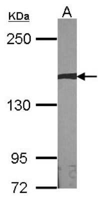 Western Blot: AUTS2 Antibody [NBP1-32784]