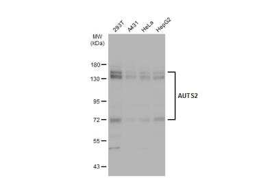 Western Blot: AUTS2 Antibody [NBP1-32784]