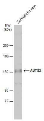 Western Blot: AUTS2 Antibody [NBP1-32784]