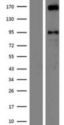 Western Blot: AUTS2 Overexpression Lysate [NBP2-09437]