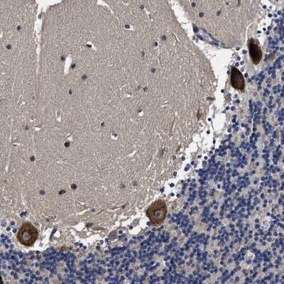 Immunohistochemistry-Paraffin: AVEN Antibody [NBP1-87313]