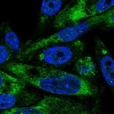 Immunocytochemistry/ Immunofluorescence: AVL9 Antibody [NBP2-14337]