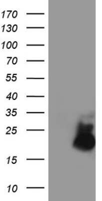 Western Blot: AVPI1 Antibody (OTI1G1) [NBP2-46559]