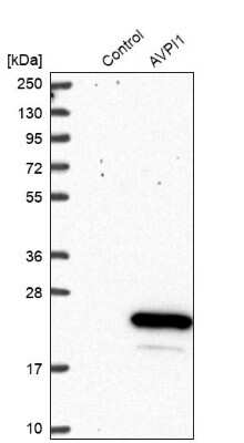 Western Blot: AVPI1 Antibody [NBP1-80888]