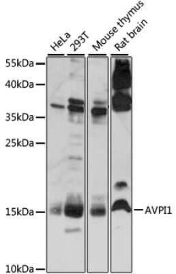 Western Blot: AVPI1 AntibodyAzide and BSA Free [NBP2-92241]