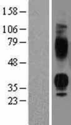 Western Blot: V1b Vasopressin R/AVPR1B Overexpression Lysate [NBP2-04173]