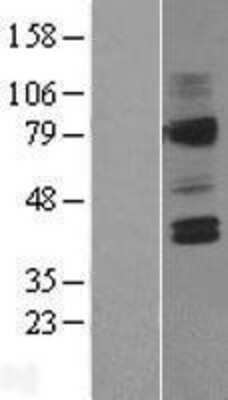 Western Blot: V2 Vasopressin R/AVPR2 Overexpression Lysate [NBL1-07867]