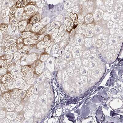 Immunohistochemistry-Paraffin: AWAT1 Antibody [NBP2-49395]